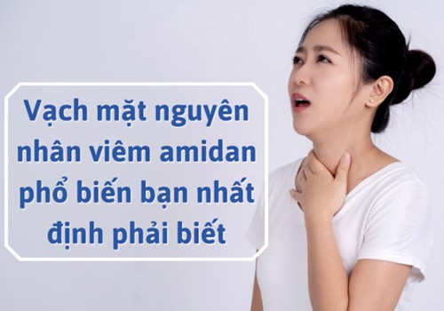 Vạch mặt nguyên nhân viêm amidan phổ biến bạn nhất định phải biết